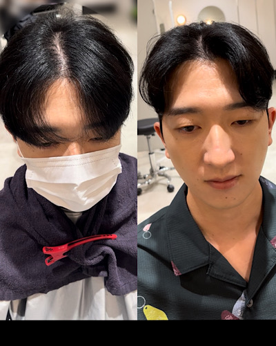 Before&After画像