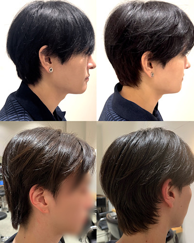 Before&After画像